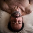 John Belleme getting acupuncture